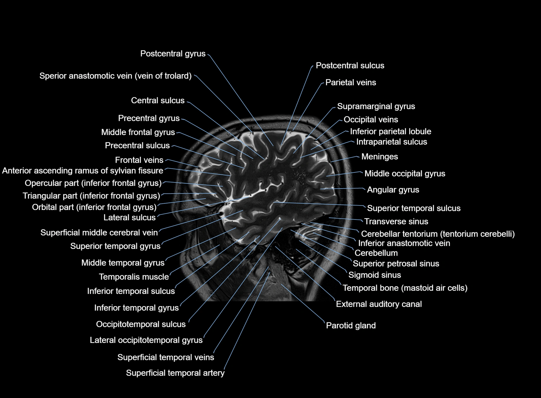 brain sagittal anatomy 3T MRI images -img-00001-00013.webp